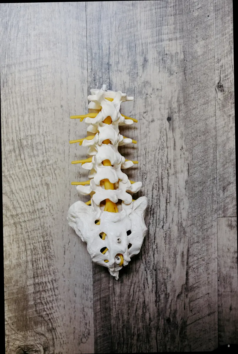 척추측만증 종류 한눈에 보기
